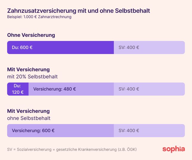 Eine Grafik, die auf Basis eines Beispiels von einer Zahnarztrechnung von 1.000 € aufzeigt, wie viel die Behandlung mit/ohne Versicherung mit/ohne Selbstbehalt kostet.